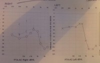 Dec Audiogram